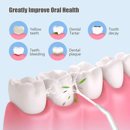 Dental Irrigator