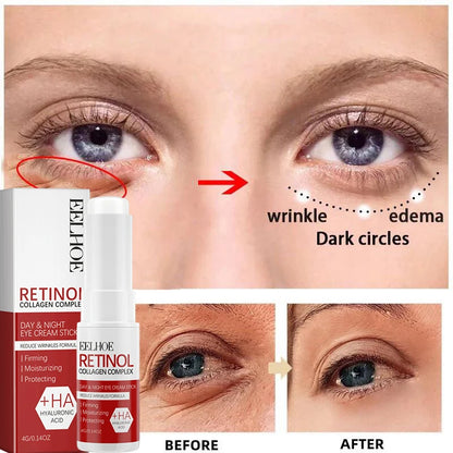 Retinol Wrinkle Remover