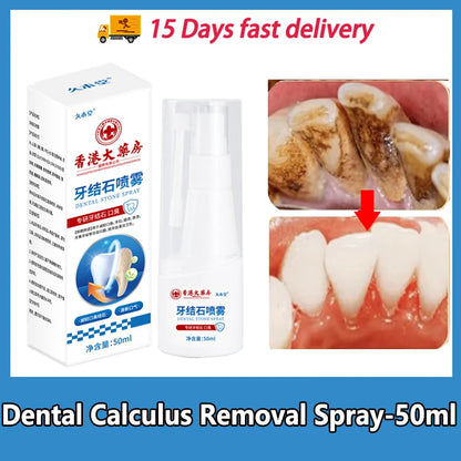 Dental Calculus Remover